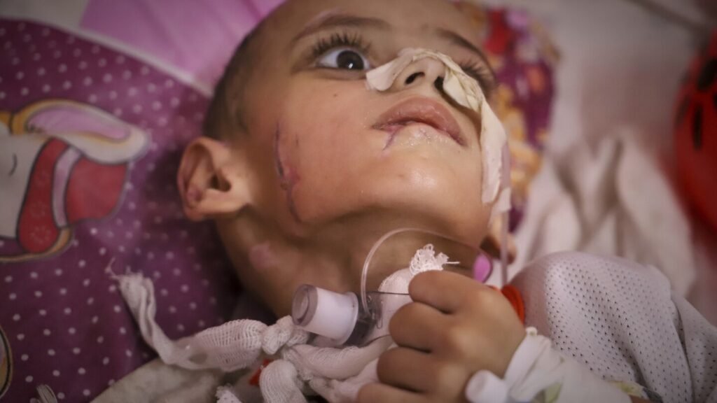 A boy in Gaza with brain damage fights for his life amid blockade