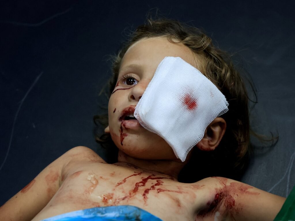 I was training to heal eyes in Gaza. Then everything went dark