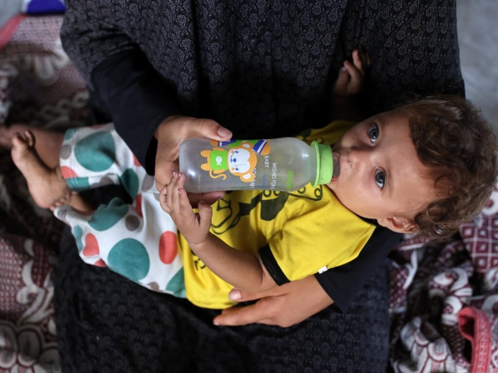 UN says every child under five in Gaza at risk of malnourishment