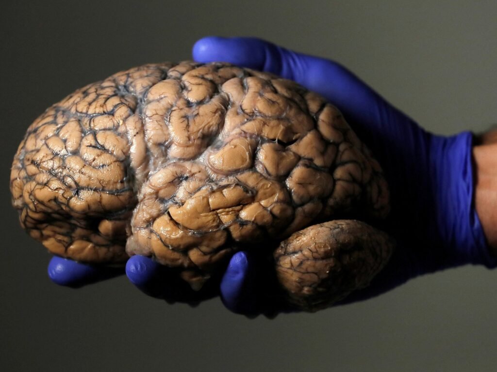 Does adolescence last until 32? Scientists unlock brain’s five eras