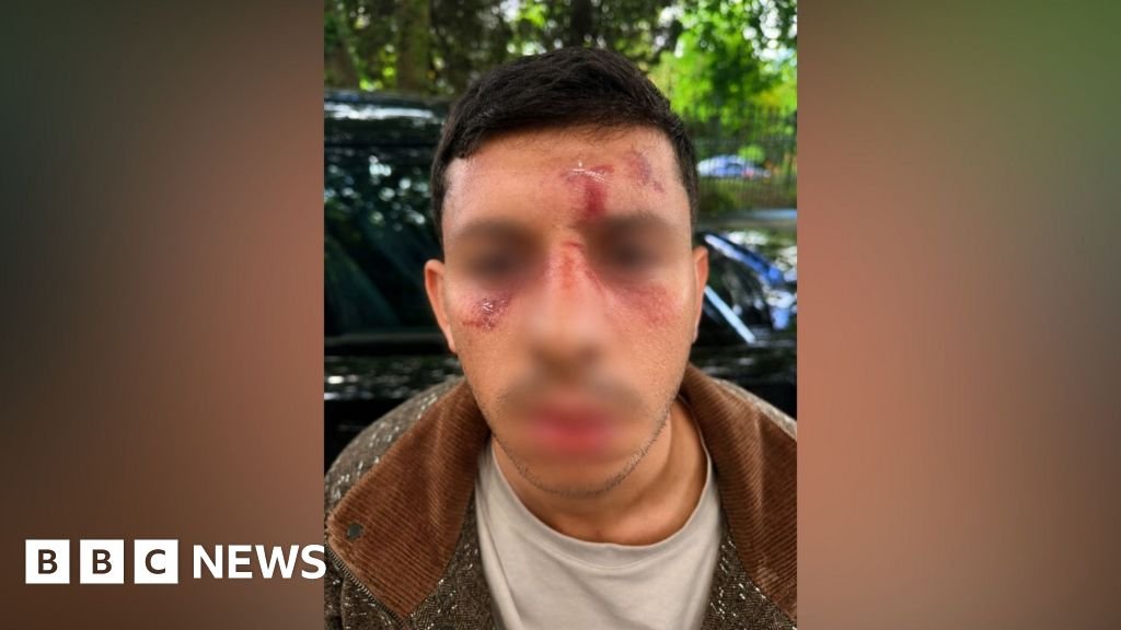 Jewish man 'kicked like animal' in London attackThe Metropolitan Police says it is treating the incident as an antisemitic hate crime.2 hrs agoLondon Jewish man 'kicked like animal' in London attackThe Metropolitan Police says it is treating the incident as an antisemitic hate crime.2 hrs agoLondon