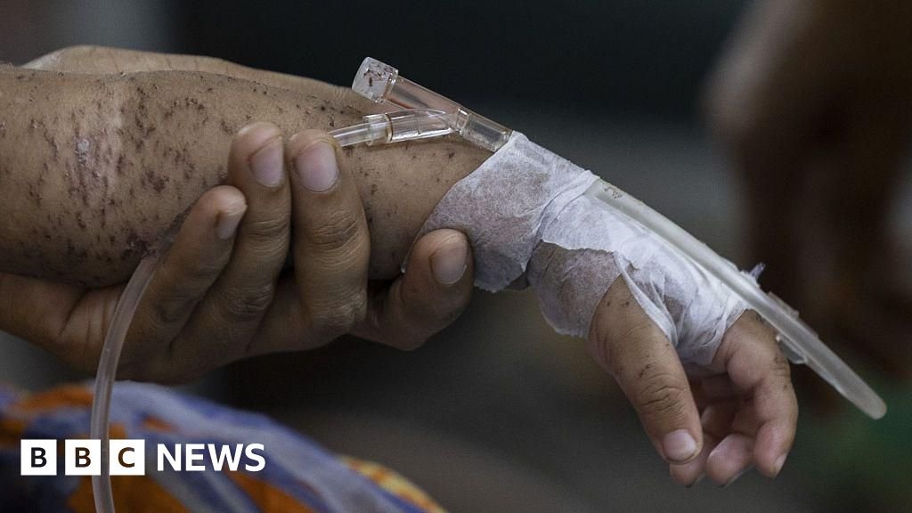 Hundreds of children die within months as measles cases soar in BangladeshThe country has recorded more than 60,000 suspected cases of measles in just over two months.2 hrs agoAsia Hundreds of children die within months as measles cases soar in BangladeshThe country has recorded more than 60,000 suspected cases of measles in just over two months.2 hrs agoAsia