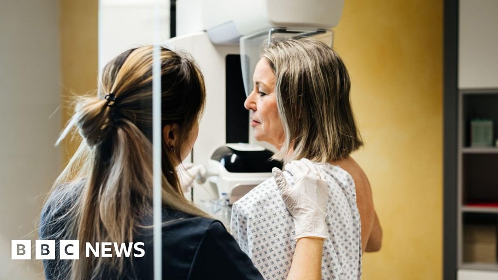 Millions of breast cancer patients could safely avoid chemotherapy, study suggestsA new DNA test could help screen whether patients require the treatment or not, according to a new international trial. 1 hr agoHealth Millions of breast cancer patients could safely avoid chemotherapy, study suggestsA new DNA test could help screen whether patients require the treatment or not, according to a new international trial. 1 hr agoHealth