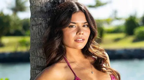 Getty Images Alannah Keyser leaning against a tree, she has long brown hair