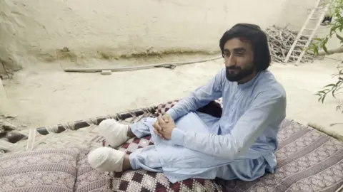 One of the 12 migrants who spoke to BBC Afghan Forensic, bearded, in a light-blue, salwar-kameez, sits on a brown patterned rug, with matching soft furnishings, to reveal the bandaged amputations of his lower legs. Behind him, a woodpile, wooden ladder and tree leaves can be glimpsed.