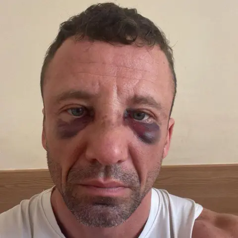 Handout Kyrylo pictured after being beaten by the recruiters