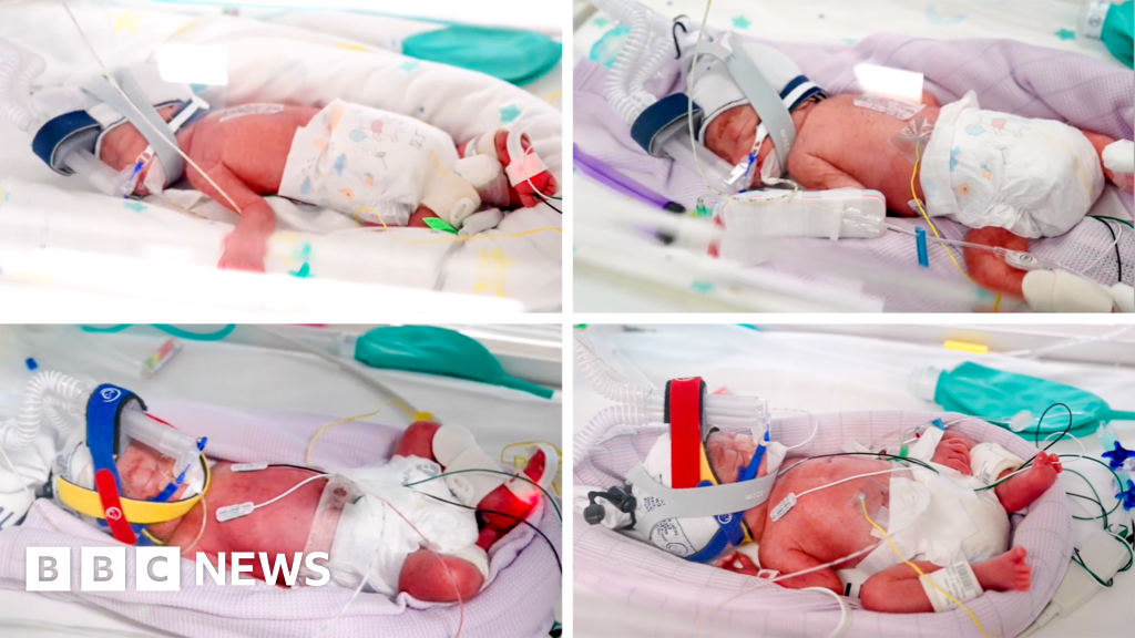 Rare identical quadruplets born in AustraliaThe parents of the four naturally-conceived girls were taken by "immense surprise" with the pregnancy, the hospital said.5 hrs agoAustralia Rare identical quadruplets born in AustraliaThe parents of the four naturally-conceived girls were taken by "immense surprise" with the pregnancy, the hospital said.5 hrs agoAustralia