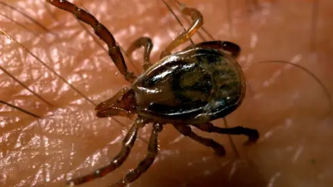 Getty A close up of a tick on a person's skin