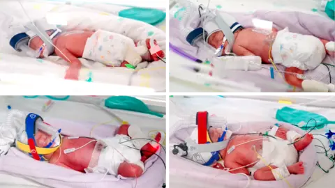 Metro North Health The quadruplet babies pictured in a composite image - they are all in the hospital's nursery, in an incubator, wearing a breathing device and several wires