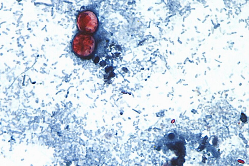 15 states now linked to iceberg lettuce cyclospora outbreak, CDC says 15 states now linked to iceberg lettuce cyclospora outbreak, CDC says