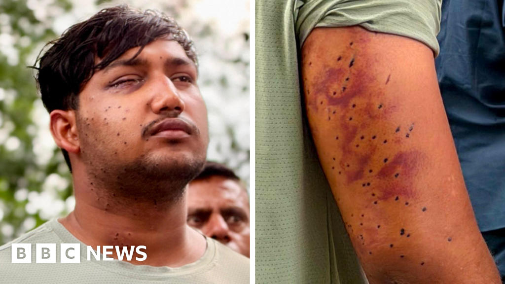 India's 'cockroach' protesters have wounds consistent with pellet-gun fire, say expertsBallistic experts say the dozens of tiny round punctures are tell-tale signs of pellet gun injuries.32 mins agoAsia India's 'cockroach' protesters have wounds consistent with pellet-gun fire, say expertsBallistic experts say the dozens of tiny round punctures are tell-tale signs of pellet gun injuries.32 mins agoAsia