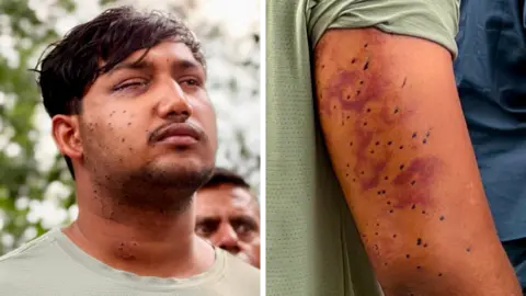 Congress Party Sahil Lochab's face and right arm which show the pellet gun wounds on his body