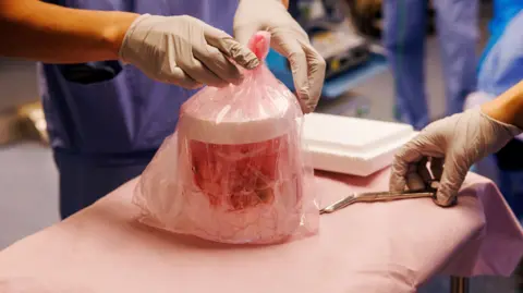 Kate Flock/Massachusetts General Hospital A close-up view shows gloved hands handling a translucent pink plastic bag on a covered medical table. Inside the bag is a cylindrical container holding red fluid, with a white lid visible near the top. Another gloved hand reaches toward a metal surgical instrument resting on the edge of the table. The background is softly out of focus, revealing a clinical environment with people in blue medical scrubs and equipment. 