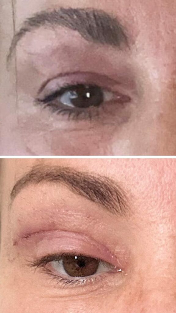 'My eyelids became infected - I was scared to sleep'Three women describe what happened when they travelled abroad for cheap "bleph" eyelid surgery.14 mins ago