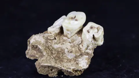 MAPANG Project A small segment of the remains of a human jaw with three teeth. The background is black.