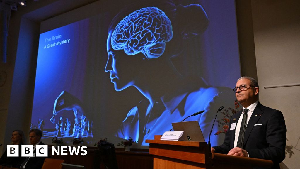 Nobel Prize awarded for revealing inner workings of the brainUS psychiatrist and neurologist Karl Deisseroth and his German colleagues Peter Hegemann and Georg Nagel have been awarded for their work.2 hrs agoHealth Nobel Prize awarded for revealing inner workings of the brainUS psychiatrist and neurologist Karl Deisseroth and his German colleagues Peter Hegemann and Georg Nagel have been awarded for their work.2 hrs agoHealth