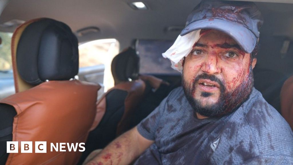Palestinians and US journalist injured by Israeli settlers in West Bank harvest attackThe BBC sees masked settlers attack Palestinians trying to harvest olives, amid a surge in similar incidents.44 mins agoWorld Palestinians and US journalist injured by Israeli settlers in West Bank harvest attackThe BBC sees masked settlers attack Palestinians trying to harvest olives, amid a surge in similar incidents.44 mins agoWorld
